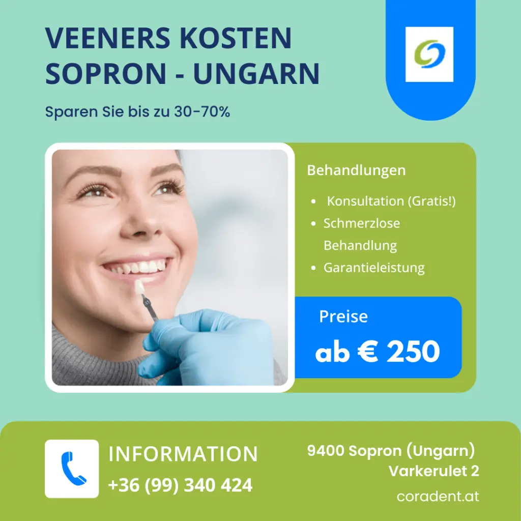 Eine preisgünstige Lösung für Veneers und Brücken in Sopron. Erfahren Sie mehr über die Kosten und Vorteile dieser zahnmedizinischen Behandlungen.