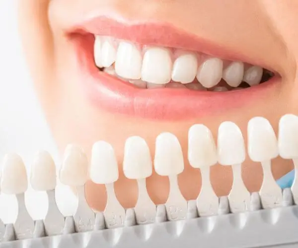 Entdecken Sie die Vorteile von Zirkonkronen für Frontzähne: ästhetisch, langlebig und biokompatibel. Perfekte Lösung für Ihr Lächeln!