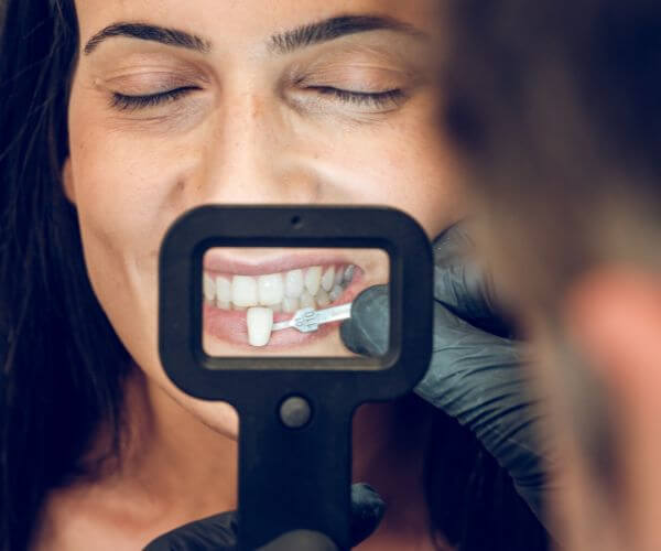 Veneers Schmerzen vermeiden: Symptome, Dauer und wann Sie den Zahnarzt kontaktieren.