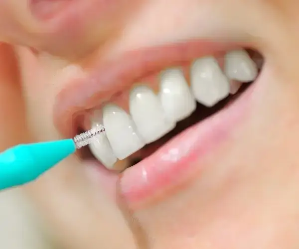 Person reinigt Zahnzwischenräume mit Interdentalbürste für gesunde Zähne.